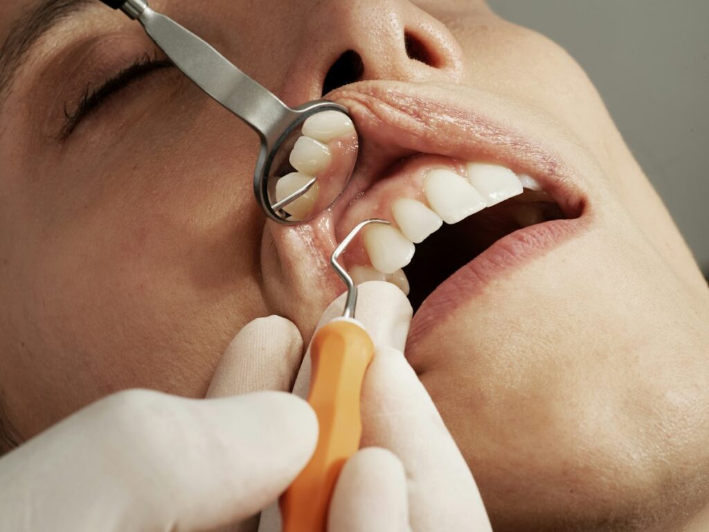 Close-up dental exam with mirror